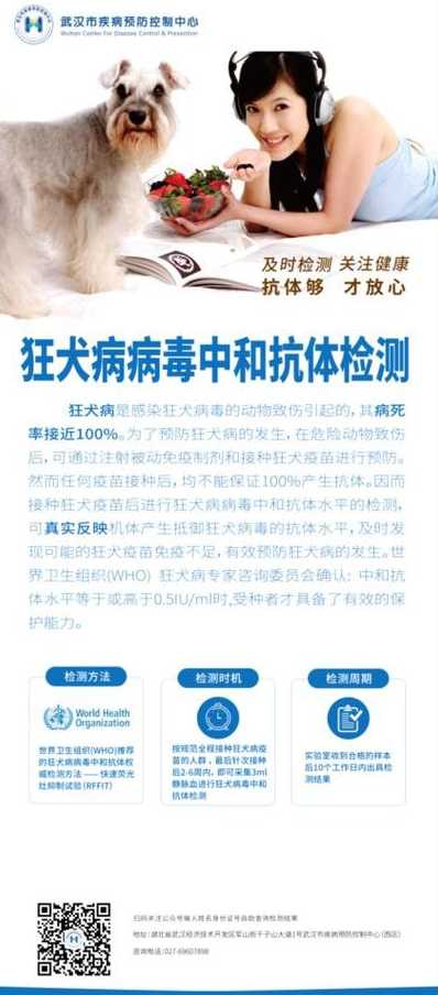 海口市哪里可以检查血清抗狂犬病毒抗体水平